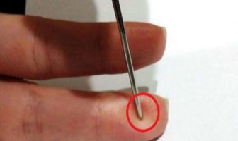Τι πρέπει να κάνετε σε έναν άνθρωπο που παθαίνει εγκεφαλικό επεισόδιο για να του σώσετε τη ζωή