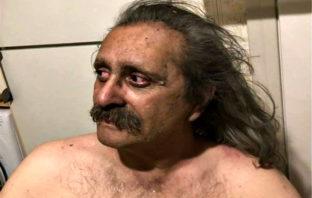 Φωτιές Αττική: Η ανάρτηση τυφλού επιζήσαντα που ραγίζει καρδιές! «Θα είχα καεί αν…»