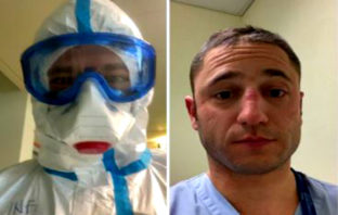 Ιταλία: Η ανάρτηση νοσοκόμου που έγινε viral – Τα σημάδια από τον κορωνοϊό