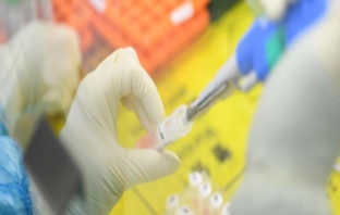 Πότε ένας ασθενής με κορωνοϊό βγαίνει από την καραντίνα-Οι οδηγίες του Υπ. Υγείας