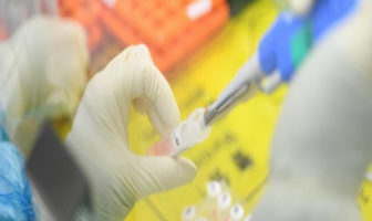Πότε ένας ασθενής με κορωνοϊό βγαίνει από την καραντίνα-Οι οδηγίες του Υπ. Υγείας